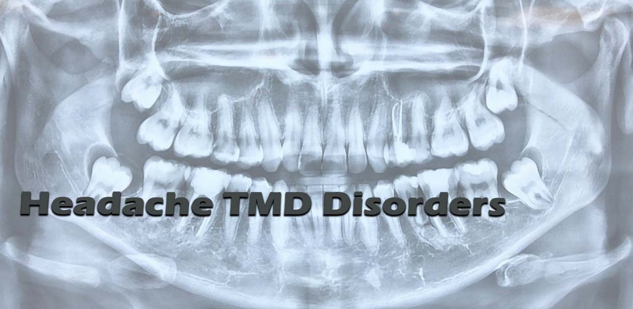 Headache TMD Disorders